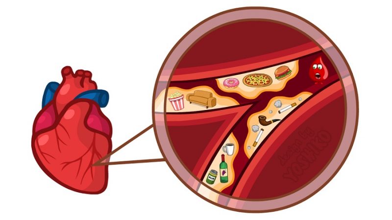 عوامل خطر برای گرفتگی رگ های قلب