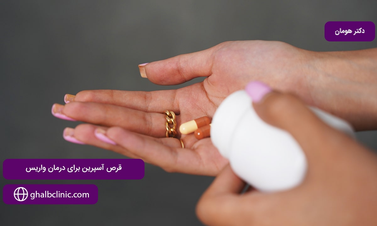 قرص آسپرین برای درمان واریس