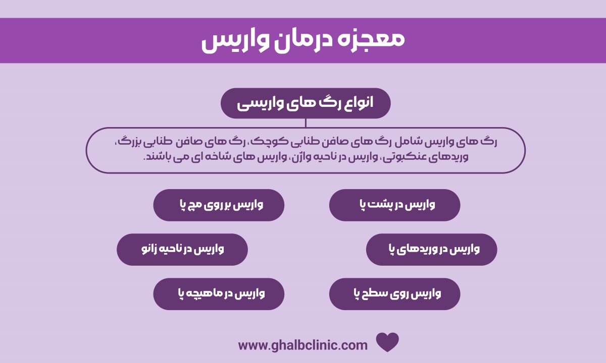 معجزه درمان واریس