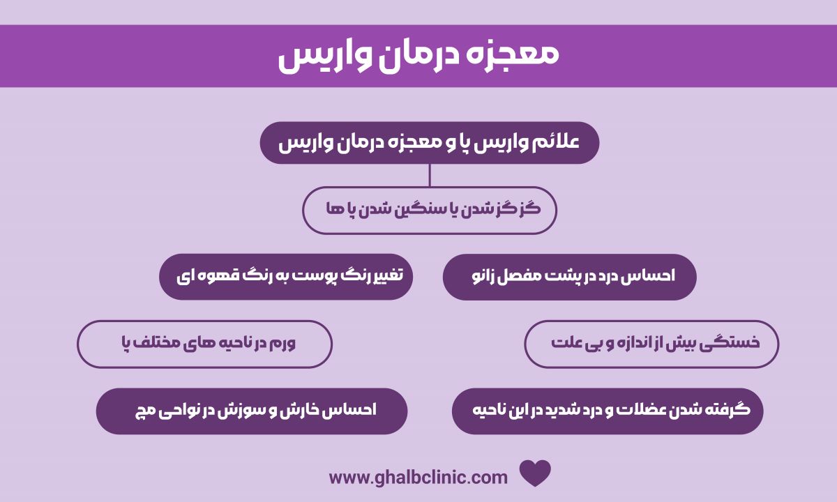 معجزه درمان واریس